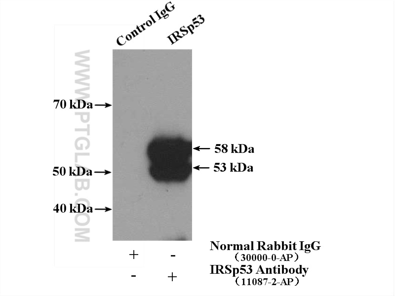 IP experiment of mouse brain using 11087-2-AP