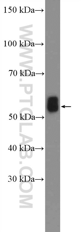 WB analysis of mouse brain using 11087-2-AP