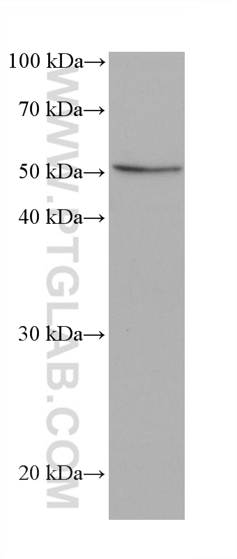 IRSp53