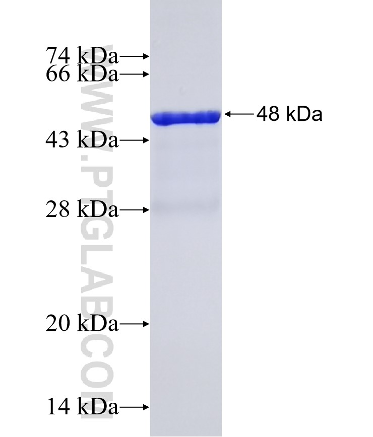 BAIAP2L1 fusion protein Ag22499 SDS-PAGE