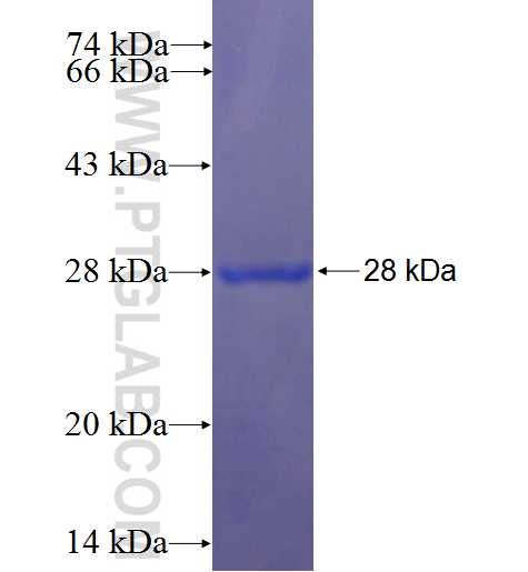 BAIAP2L1 fusion protein Ag22531 SDS-PAGE BAIAP2L1 fusion protein Ag22531 SDS-PAGE