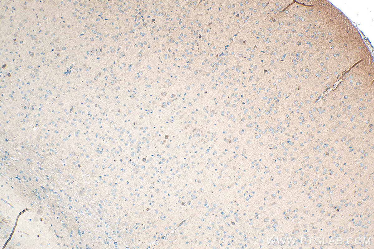 Immunohistochemical analysis of paraffin-embedded mouse brain tissue slide using 24836-1-AP (BAIAP3 antibody) at dilution of 1:200 (under 10x lens). Heat mediated antigen retrieval with Tris-EDTA buffer (pH 9.0). IHC staining of mouse brain using 24836-1-AP