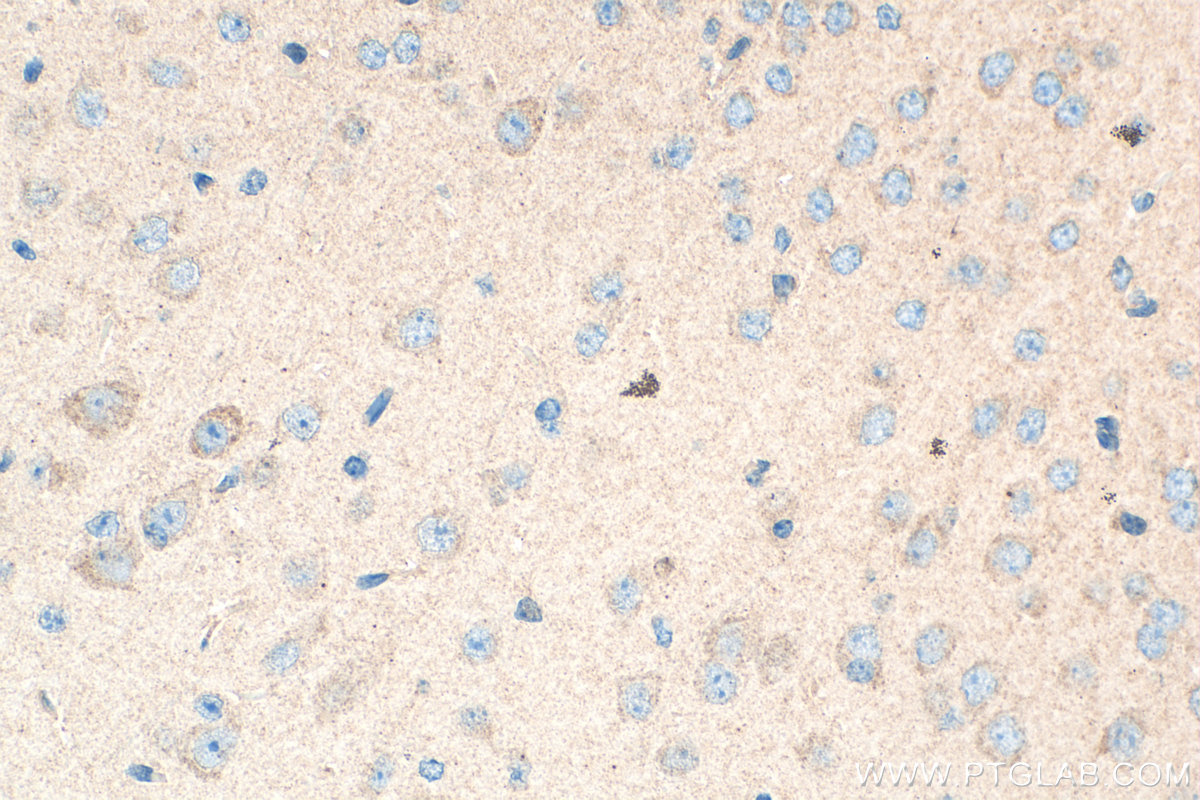 Immunohistochemical analysis of paraffin-embedded mouse brain tissue slide using 24836-1-AP (BAIAP3 antibody) at dilution of 1:200 (under 40x lens). Heat mediated antigen retrieval with Tris-EDTA buffer (pH 9.0). IHC staining of mouse brain using 24836-1-AP