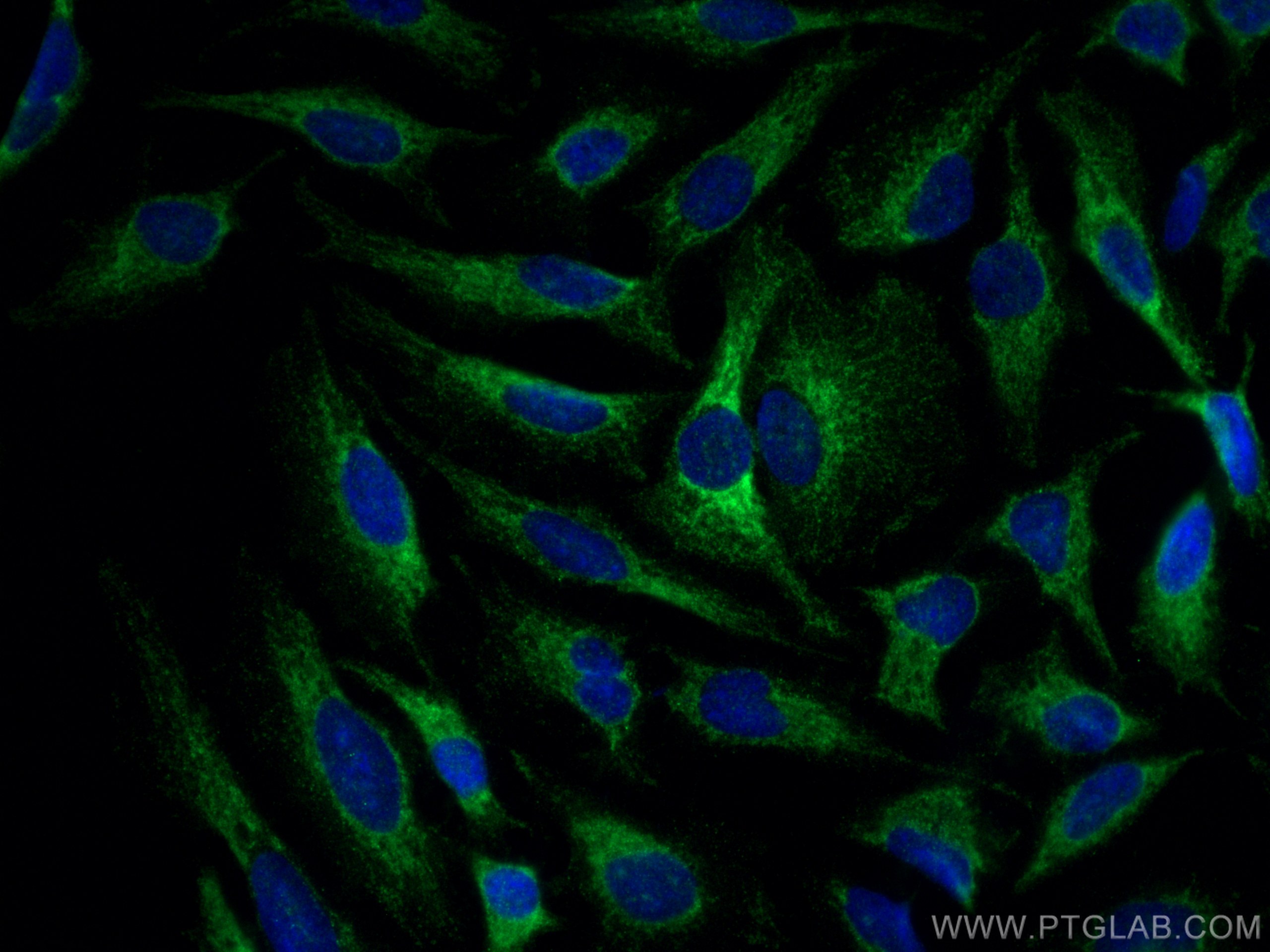 IF Staining of HeLa using 29552-1-AP