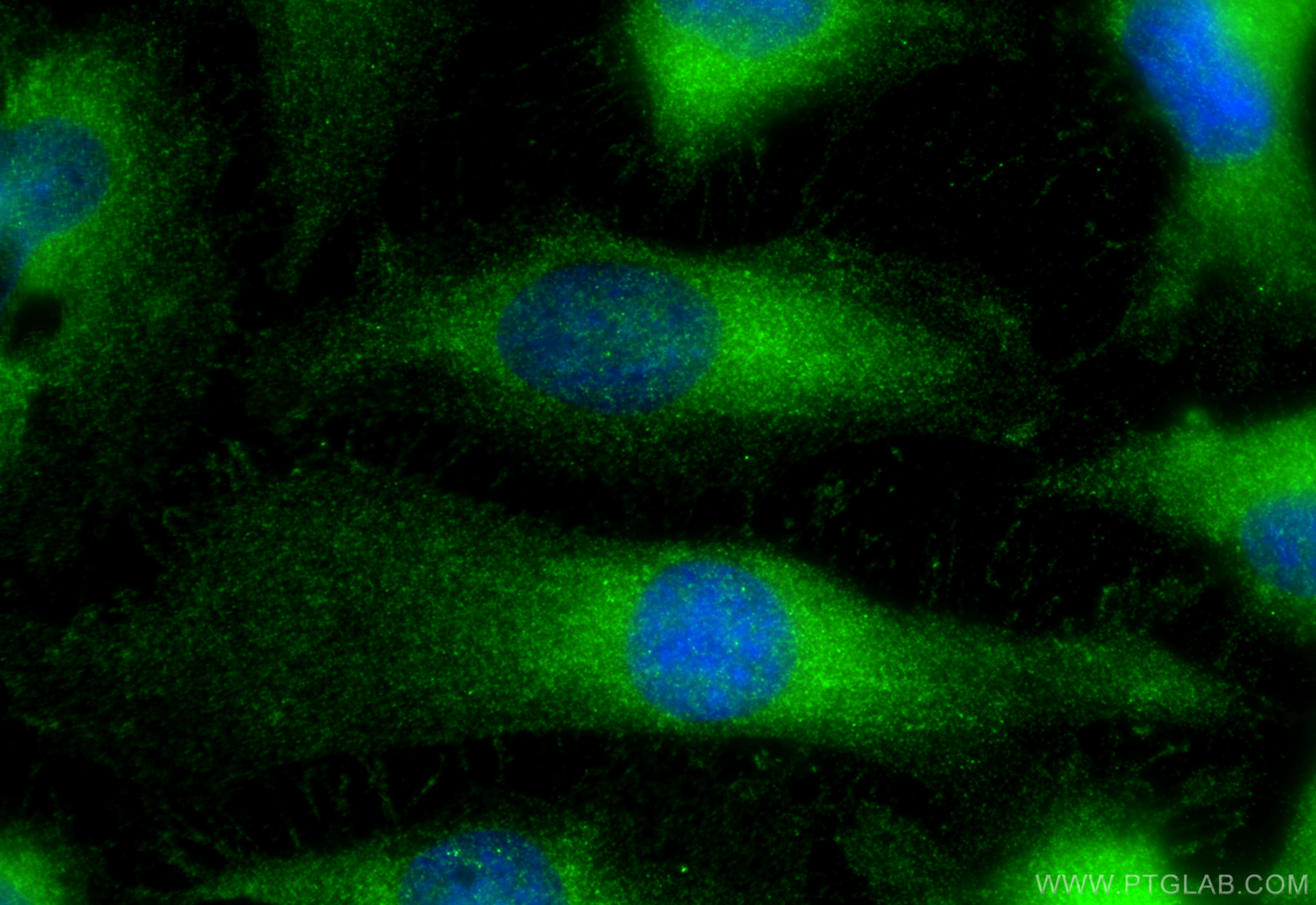 IF Staining of HeLa using 30017-1-AP