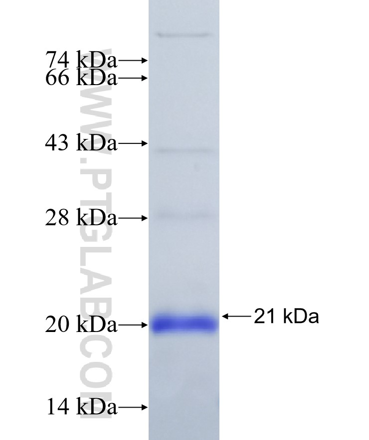 BAK fusion protein Ag31034 SDS-PAGE