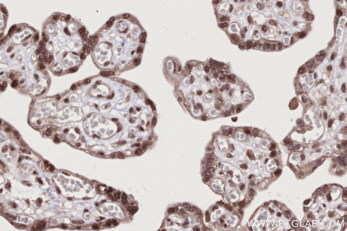 IHC staining of human placenta using 16393-1-AP
