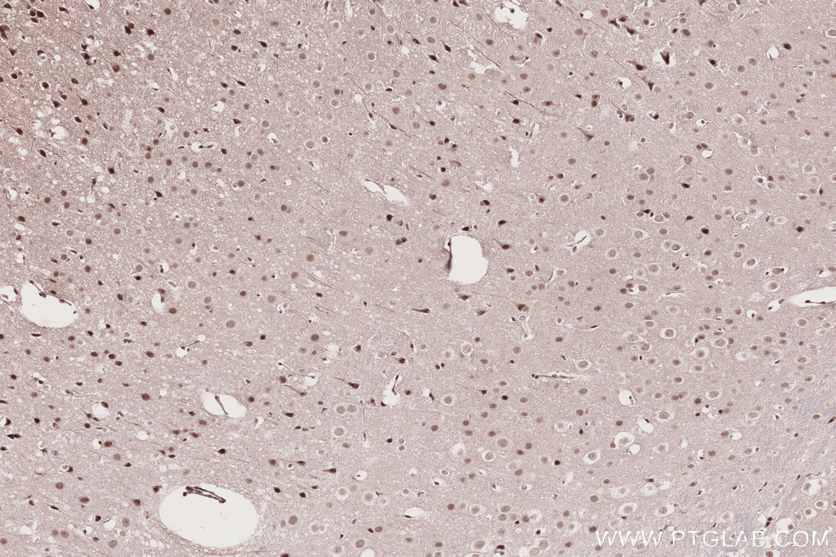 IHC staining of mouse brain using 16393-1-AP
