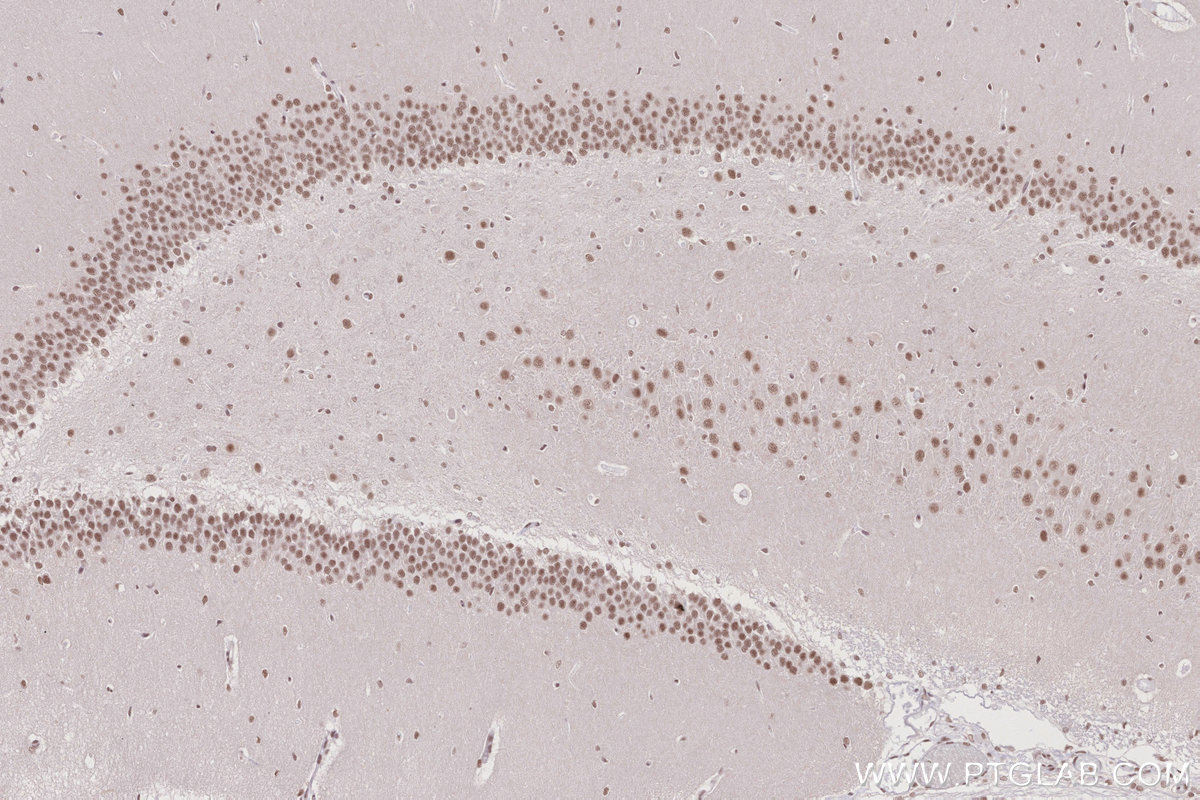 IHC staining of rat brain using 16393-1-AP