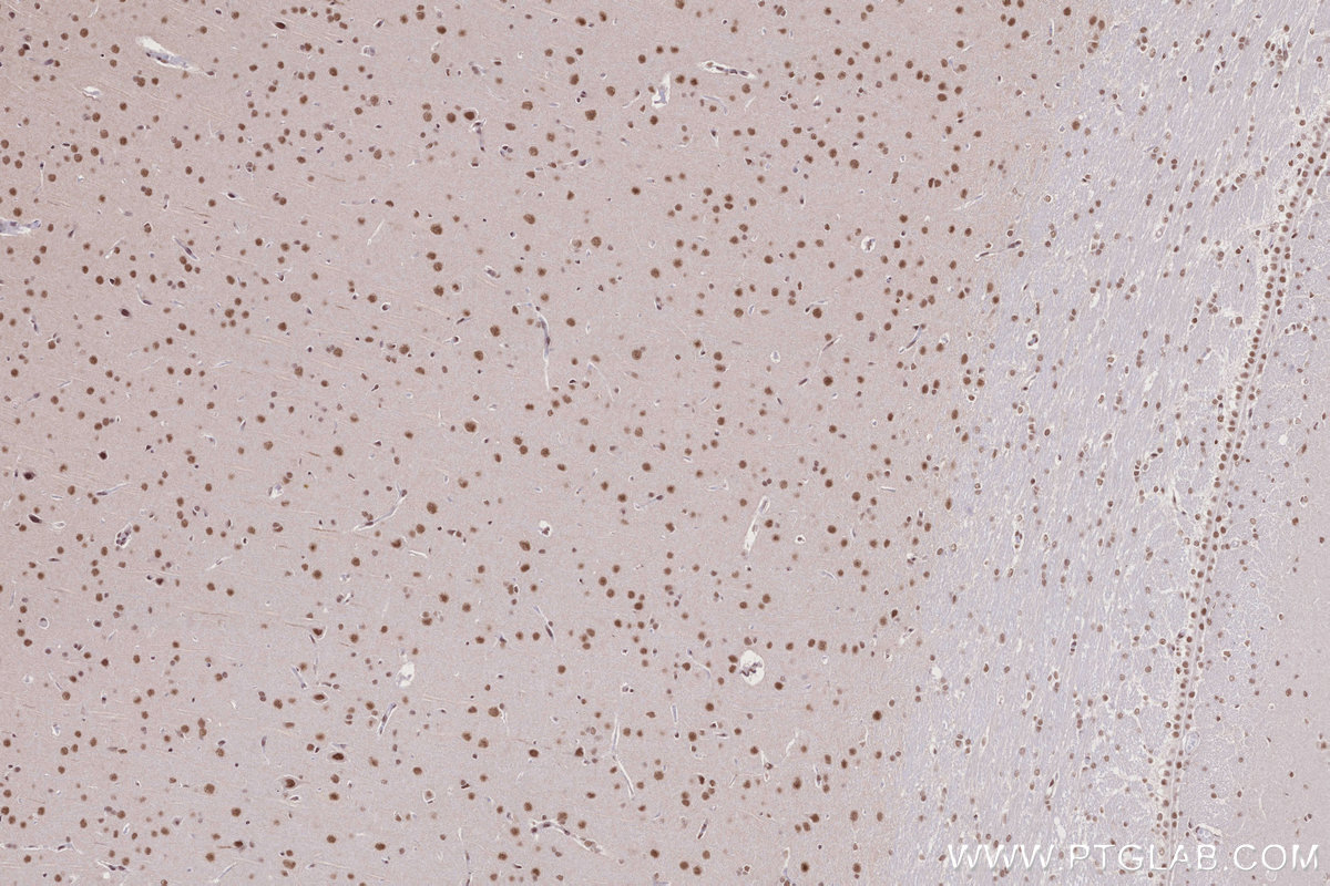 IHC staining of rat brain using 16393-1-AP