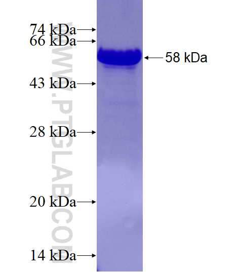 BANP fusion protein Ag9480 SDS-PAGE BANP fusion protein Ag9480 SDS-PAGE