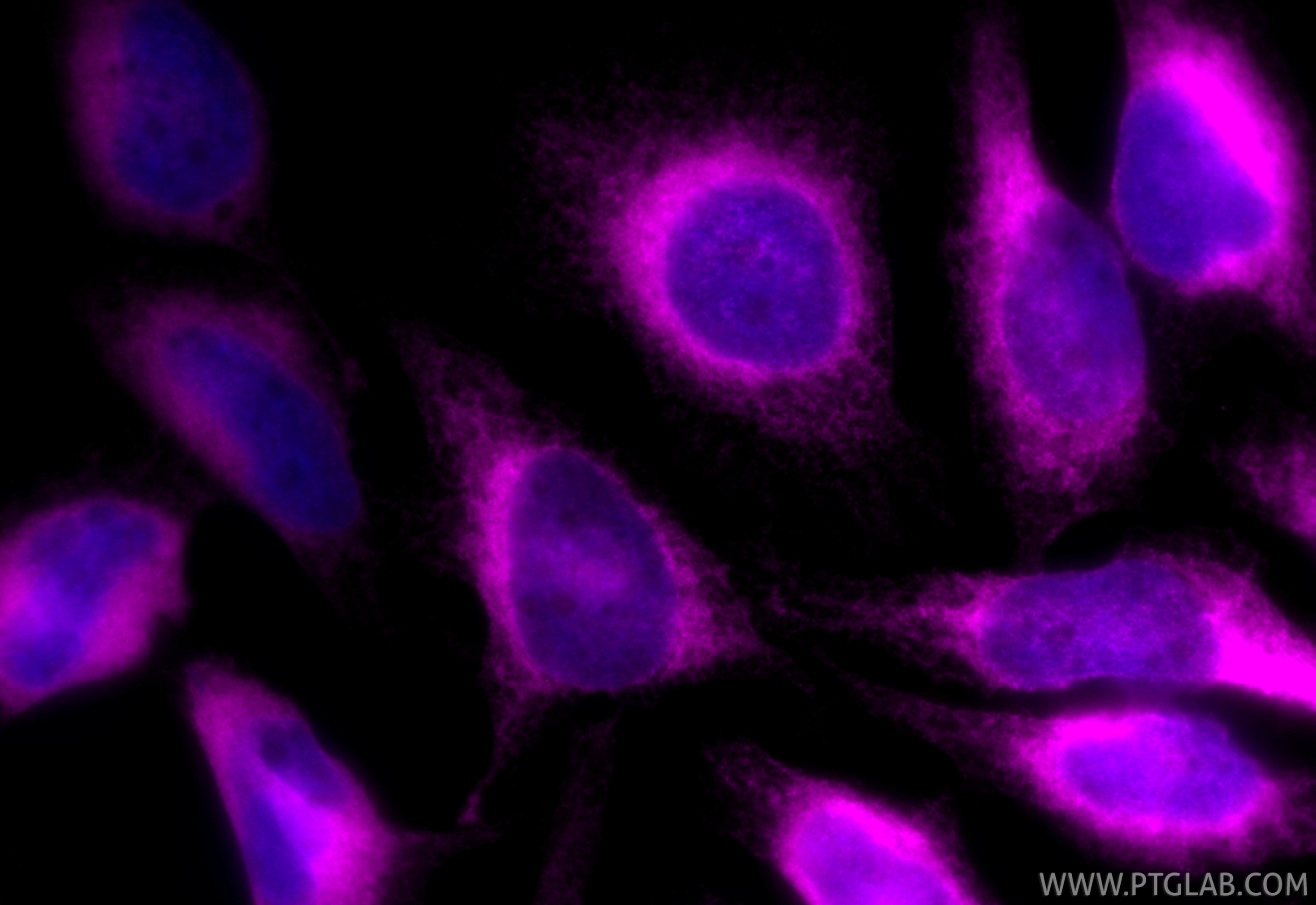 IF Staining of HeLa using CL647-11200 IF Staining of HeLa using CL647-11200