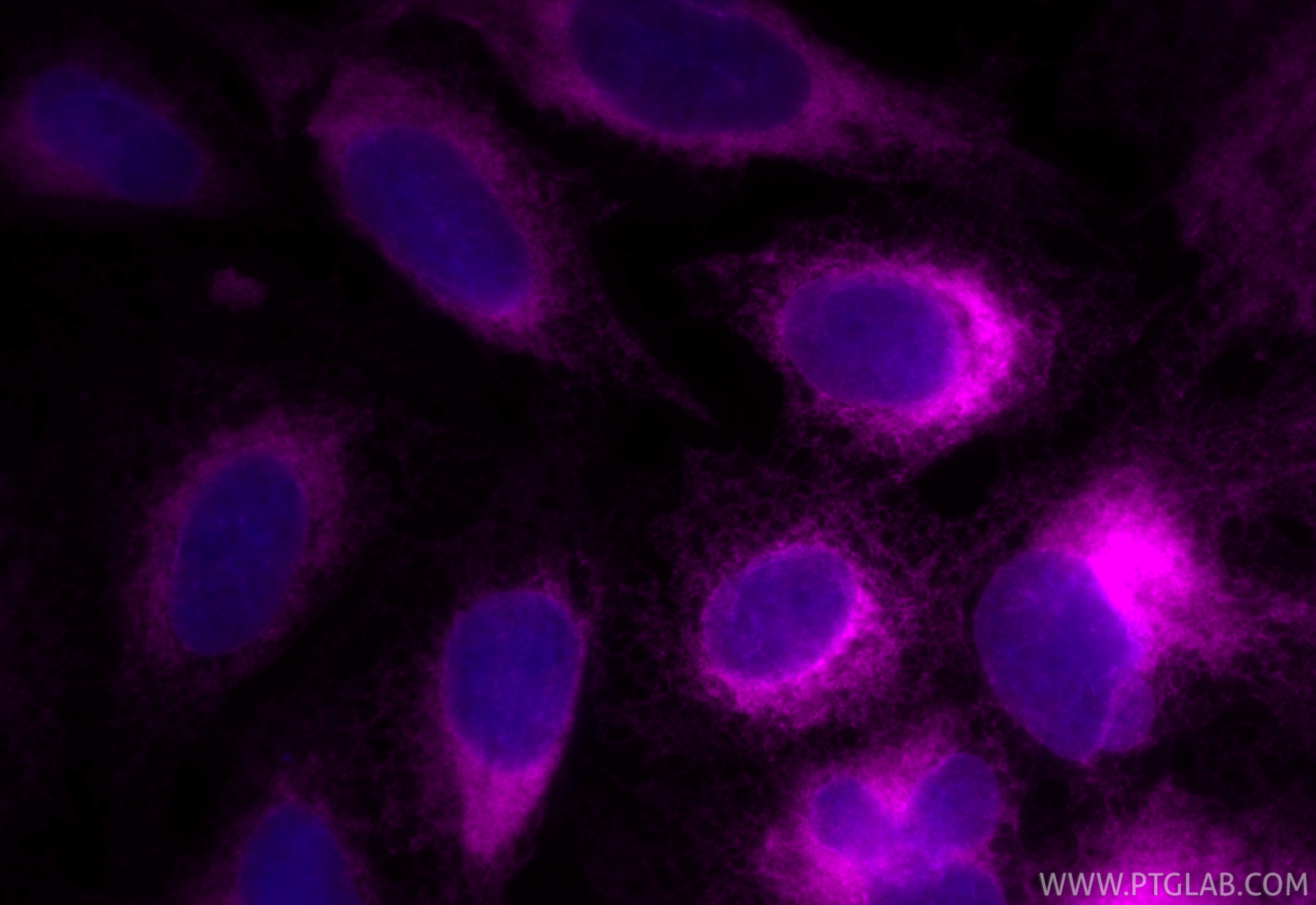 IF Staining of U2OS using CL647-11200 IF Staining of U2OS using CL647-11200
