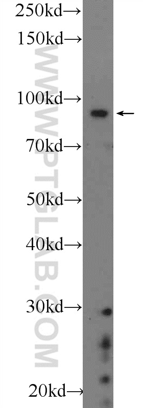 WB analysis of SH-SY5Y using 22964-1-AP