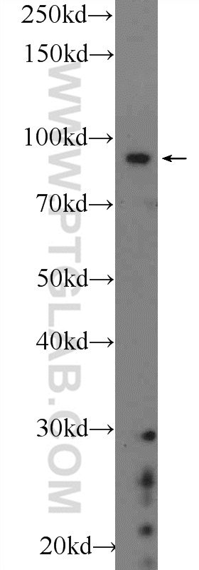 WB analysis of SH-SY5Y using 22964-1-AP