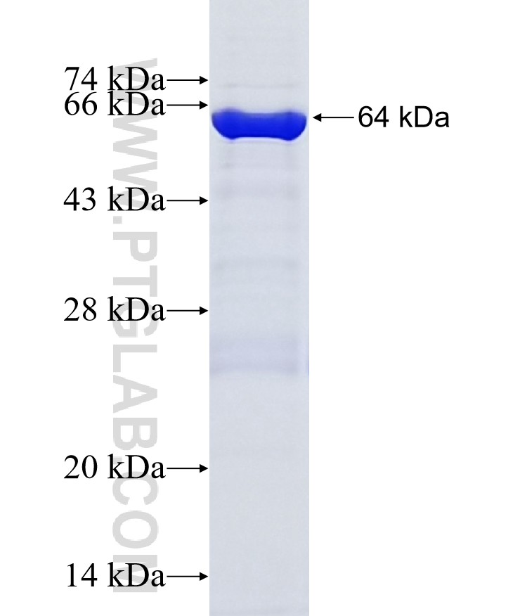 BARD1 fusion protein Ag18782 SDS-PAGE BARD1 fusion protein Ag18782 SDS-PAGE