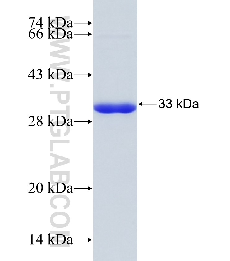 BARHL2 fusion protein Ag21229 SDS-PAGE BARHL2 fusion protein Ag21229 SDS-PAGE
