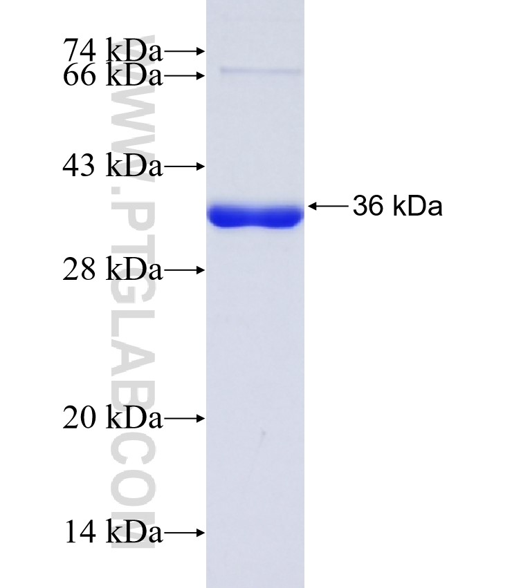 BARHL2 fusion protein Ag38955 SDS-PAGE BARHL2 fusion protein Ag38955 SDS-PAGE