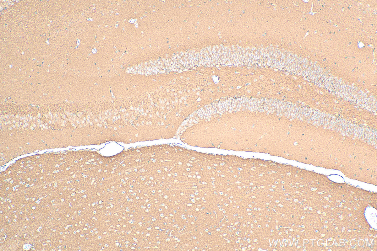 IHC staining of mouse brain using 14880-1-AP