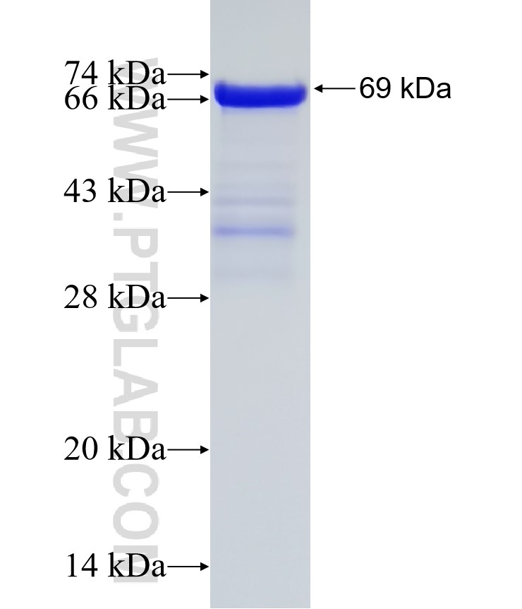 BASP1 fusion protein Ag6653 SDS-PAGE BASP1 fusion protein Ag6653 SDS-PAGE