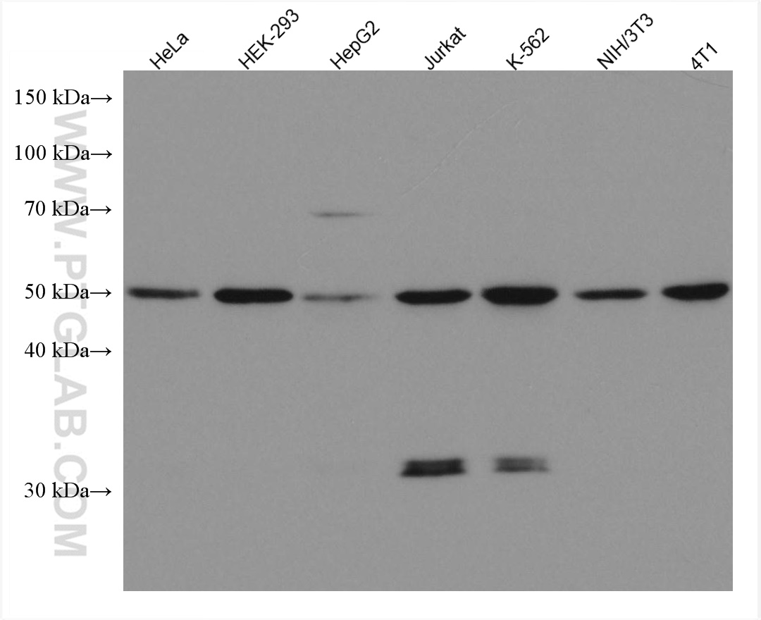 WB analysis using 67641-1-Ig