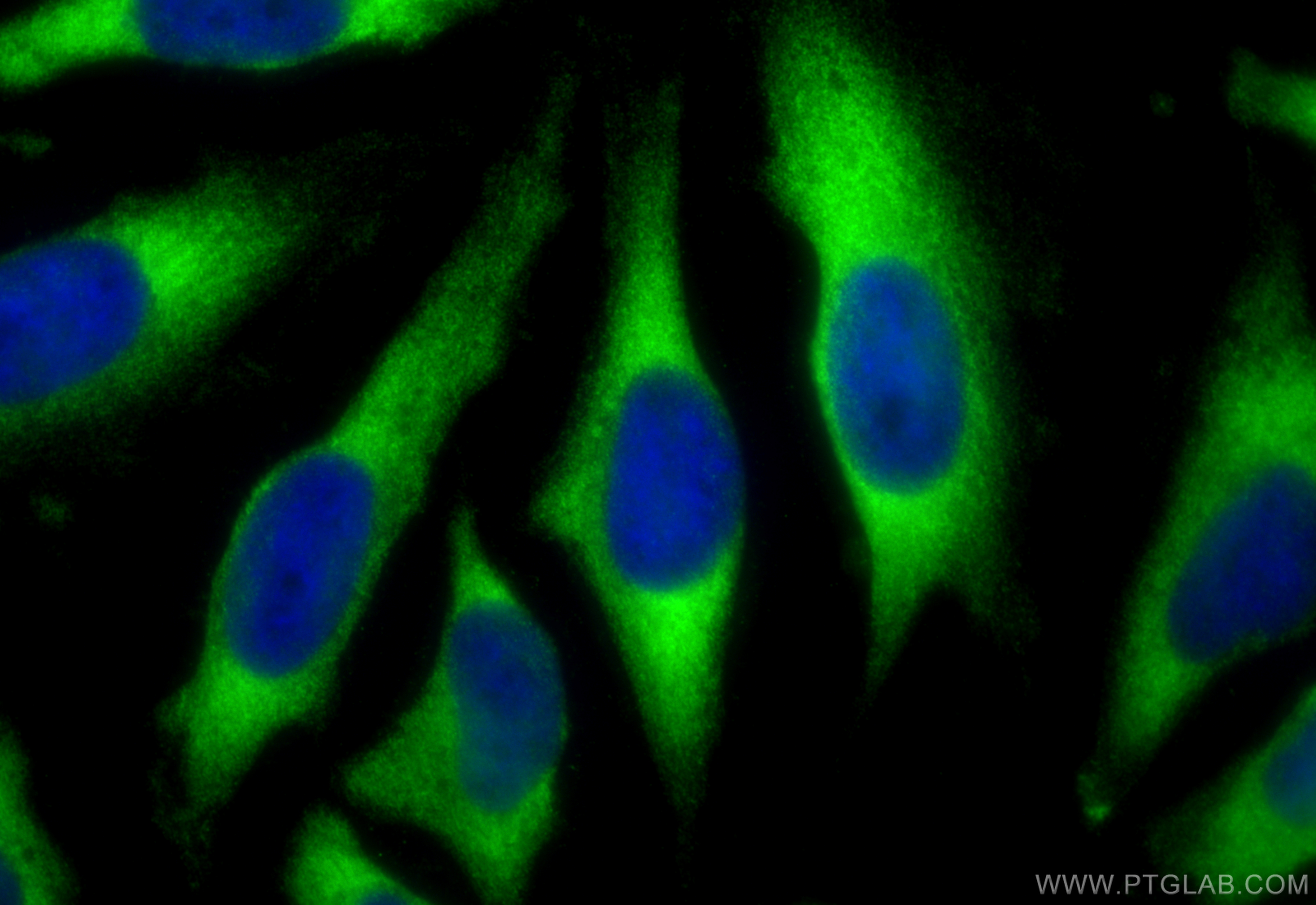 IF Staining of HeLa using 31383-1-AP (same clone as 31383-1-PBS)