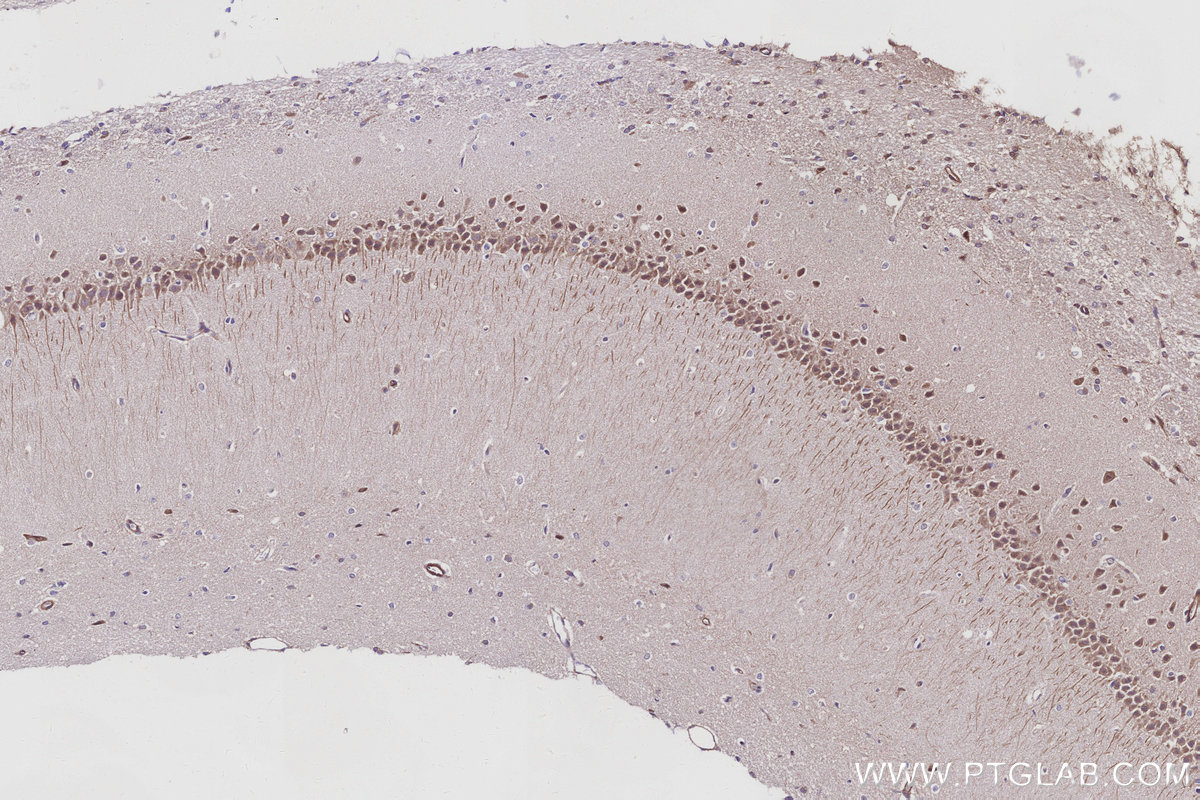 IHC staining of rat brain using 31383-1-AP (same clone as 31383-1-PBS) IHC staining of rat brain using 31383-1-AP (same clone as 31383-1-PBS)