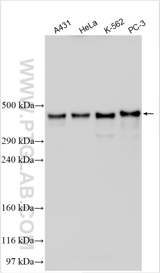WB analysis using 31383-1-AP (same clone as 31383-1-PBS)