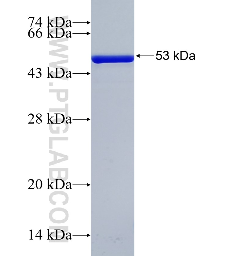 BAT2D1 fusion protein Ag35409 SDS-PAGE BAT2D1 fusion protein Ag35409 SDS-PAGE