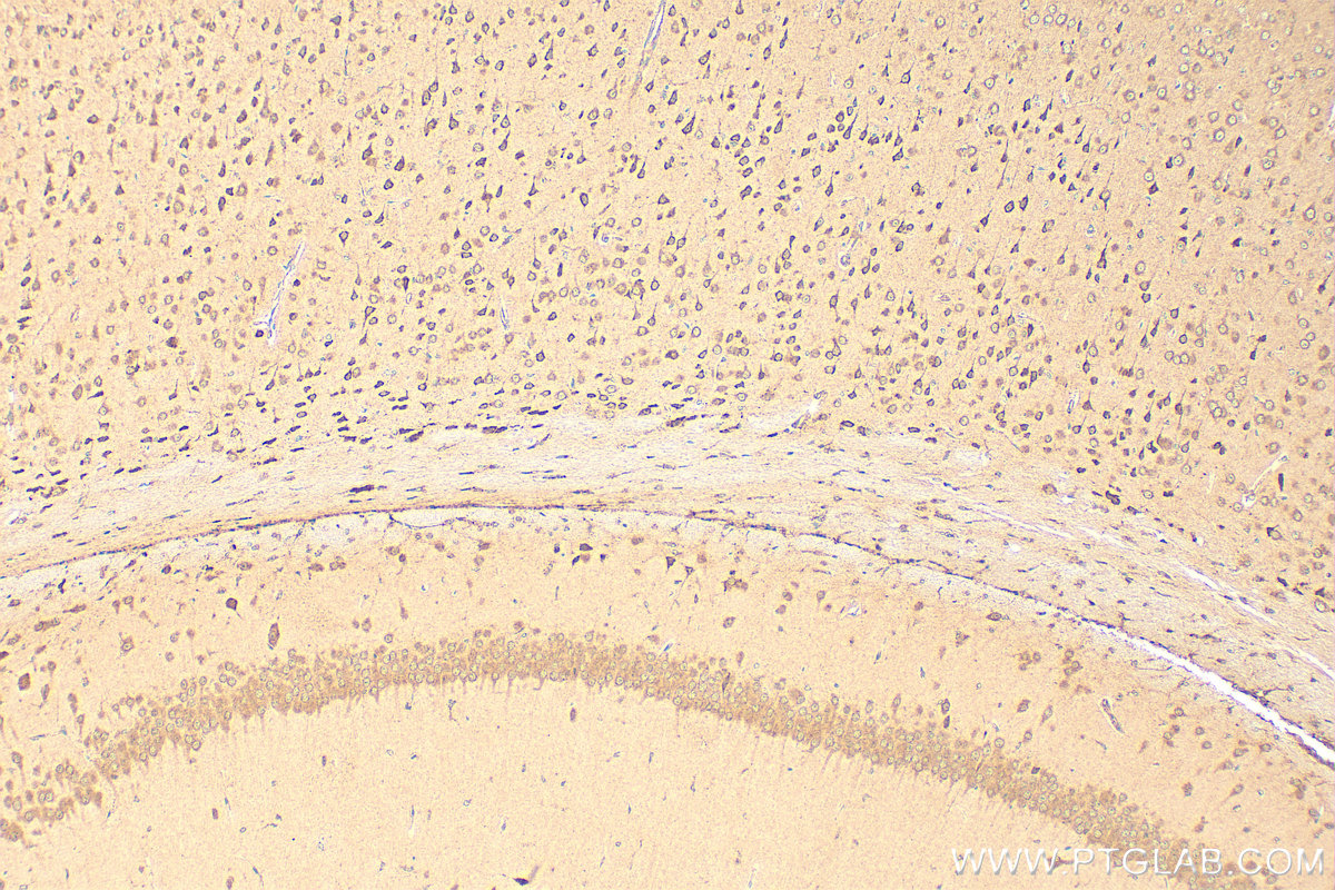 Immunohistochemical analysis of paraffin-embedded mouse brain tissue slide using 17317-1-AP (BAT5 antibody) at dilution of 1:200 (under 10x lens). Heat mediated antigen retrieval with Tris-EDTA buffer (pH 9.0). IHC staining of mouse brain using 17317-1-AP