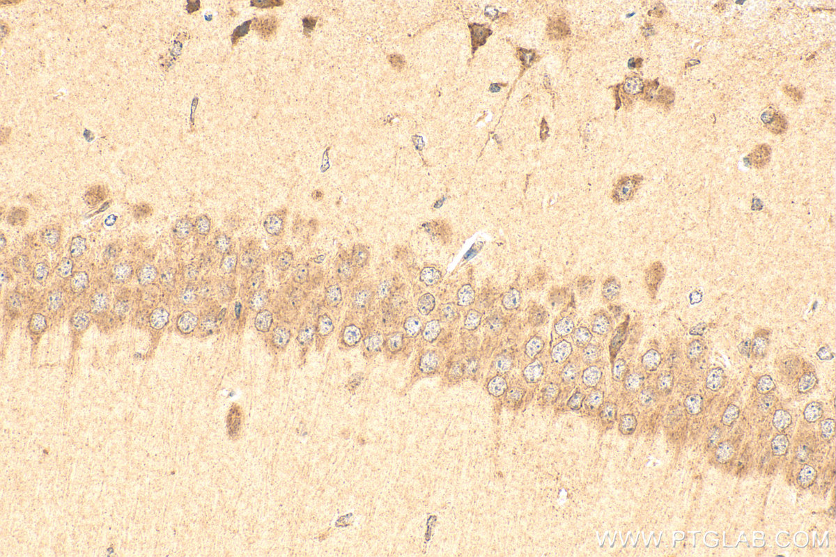 Immunohistochemical analysis of paraffin-embedded mouse brain tissue slide using 17317-1-AP (BAT5 antibody) at dilution of 1:200 (under 40x lens). Heat mediated antigen retrieval with Tris-EDTA buffer (pH 9.0). IHC staining of mouse brain using 17317-1-AP