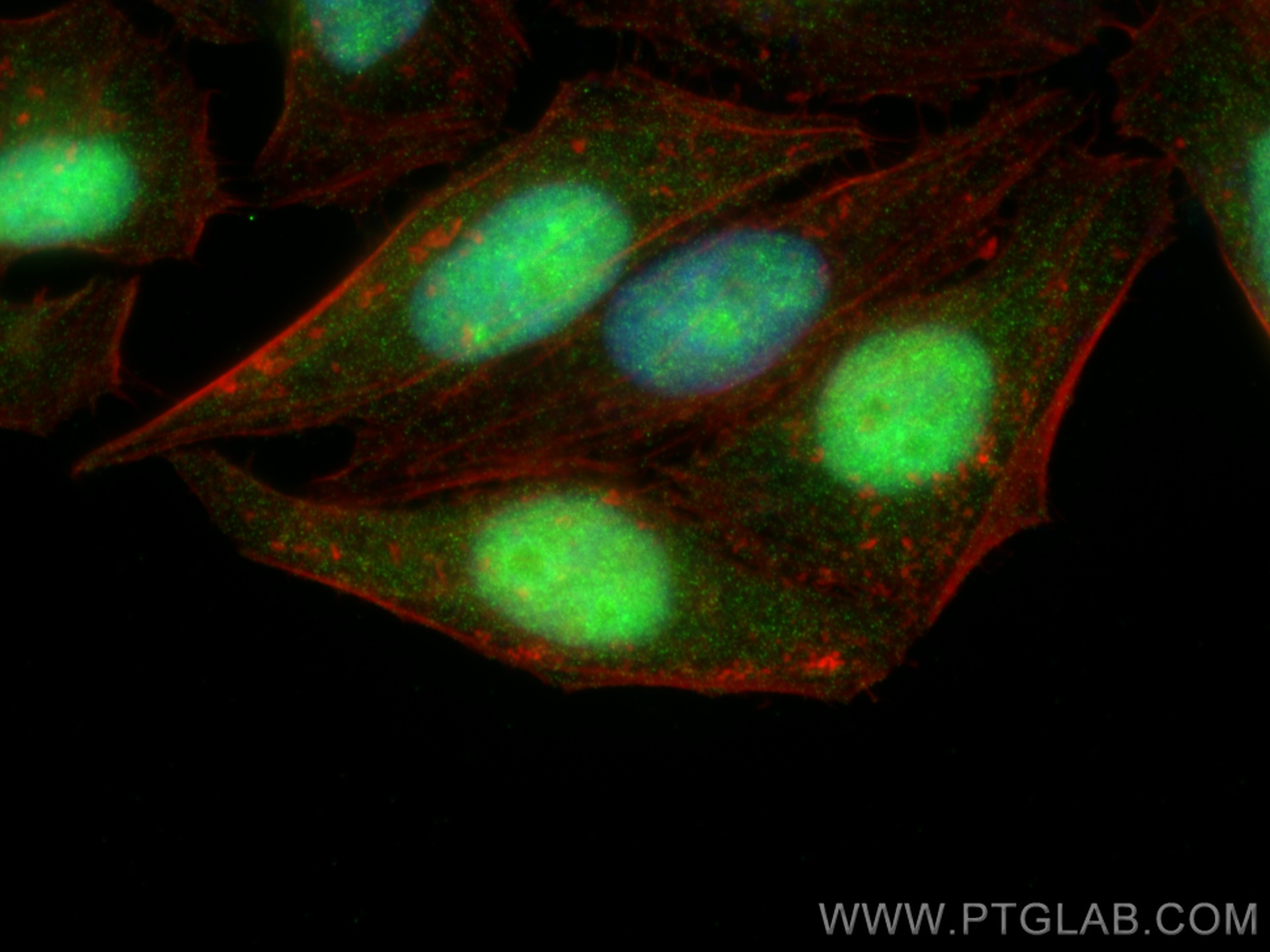 IF Staining of HepG2 using 13507-1-AP