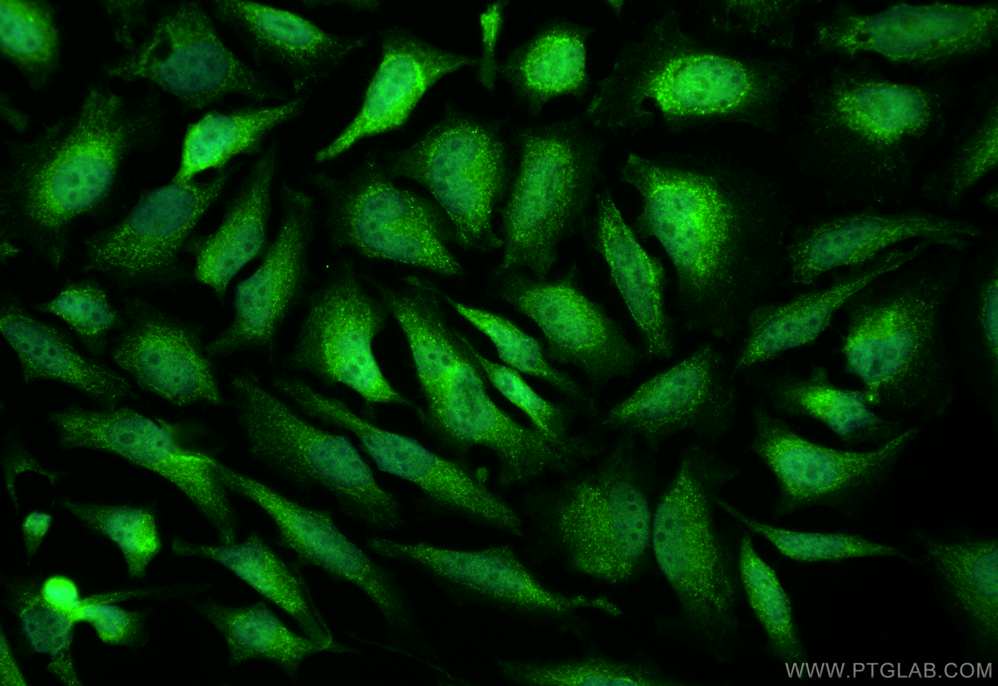 IF Staining of HeLa using 50599-2-Ig