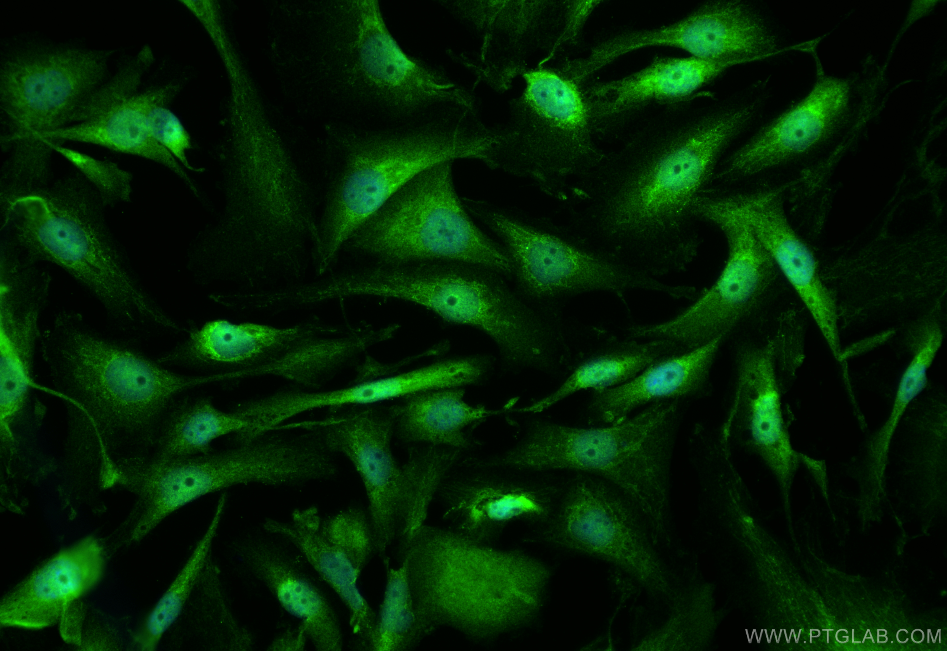 IF Staining of MDA-MB-231 using 50599-2-Ig