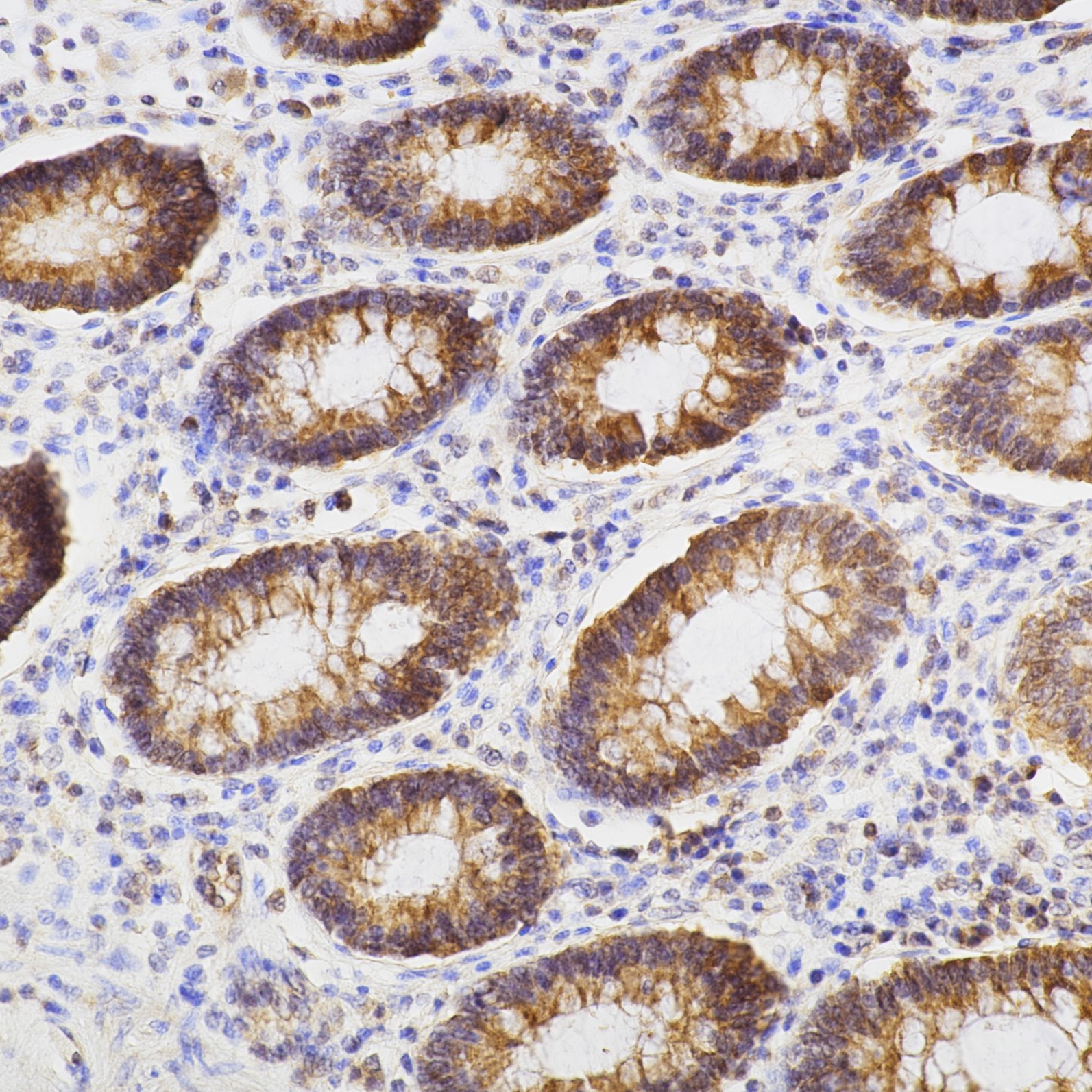 IHC staining of human colon using 60267-1-Ig