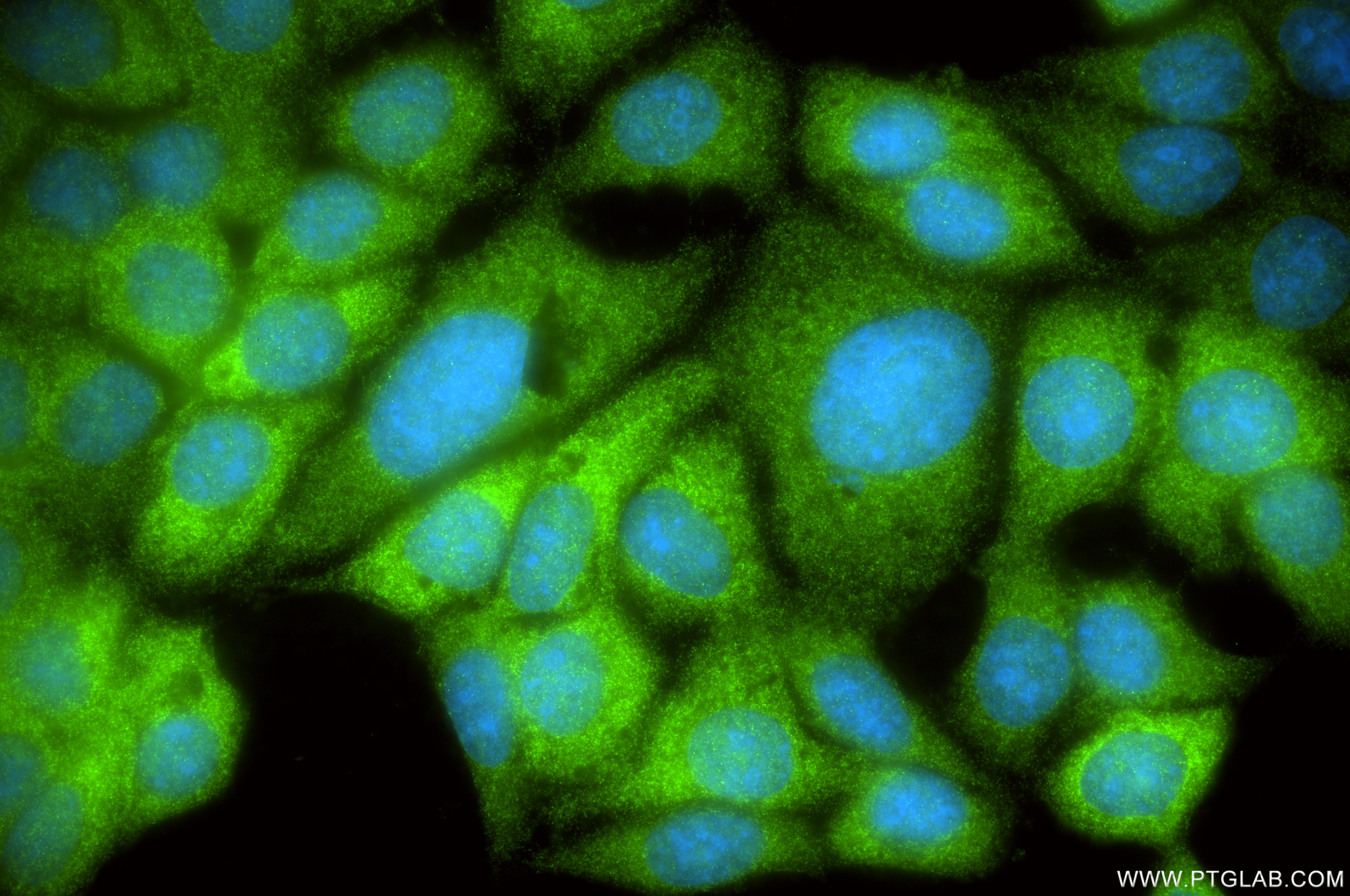 IF Staining of MCF-7 using 81789-4-RR