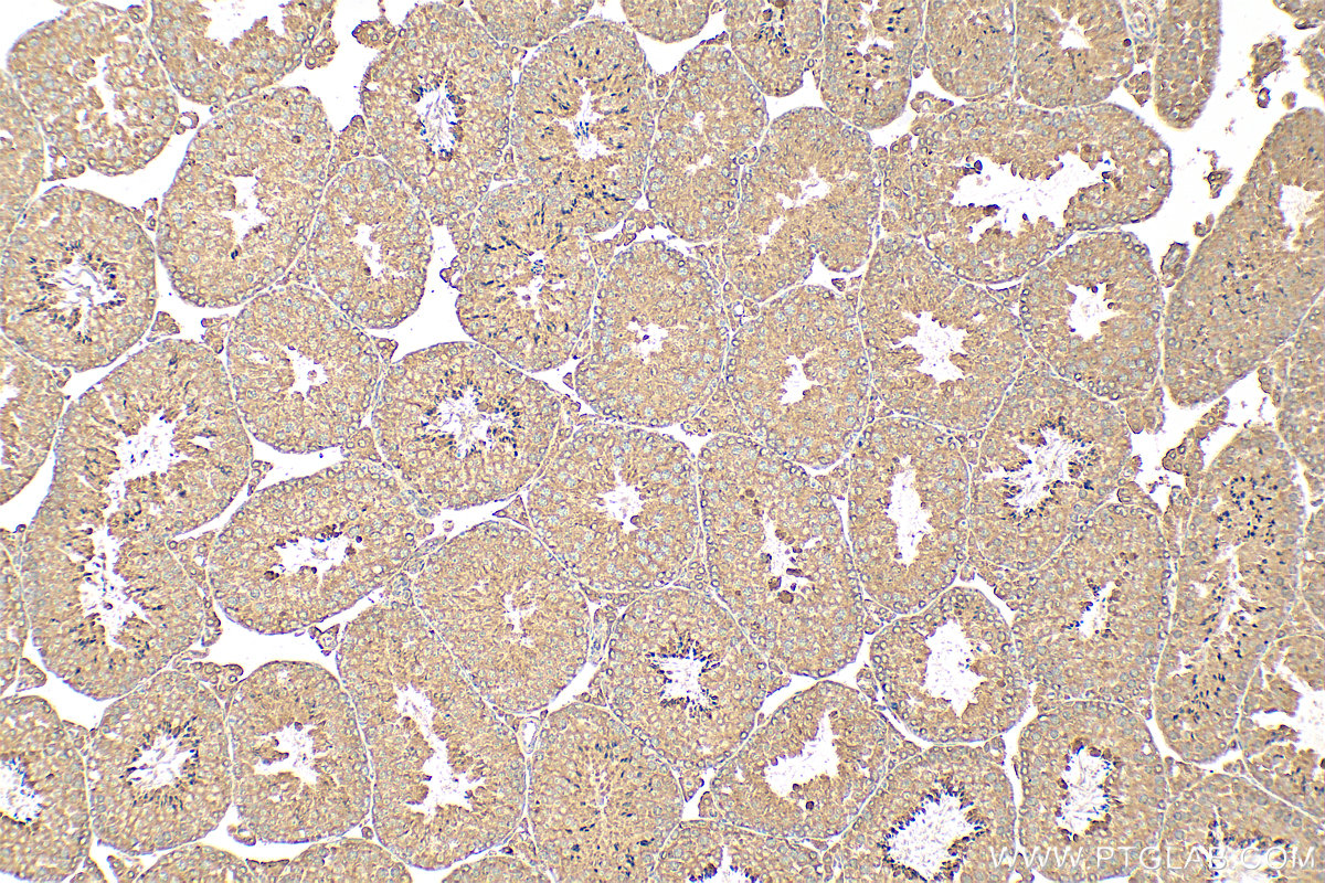 IHC staining of mouse testis using 24337-1-AP