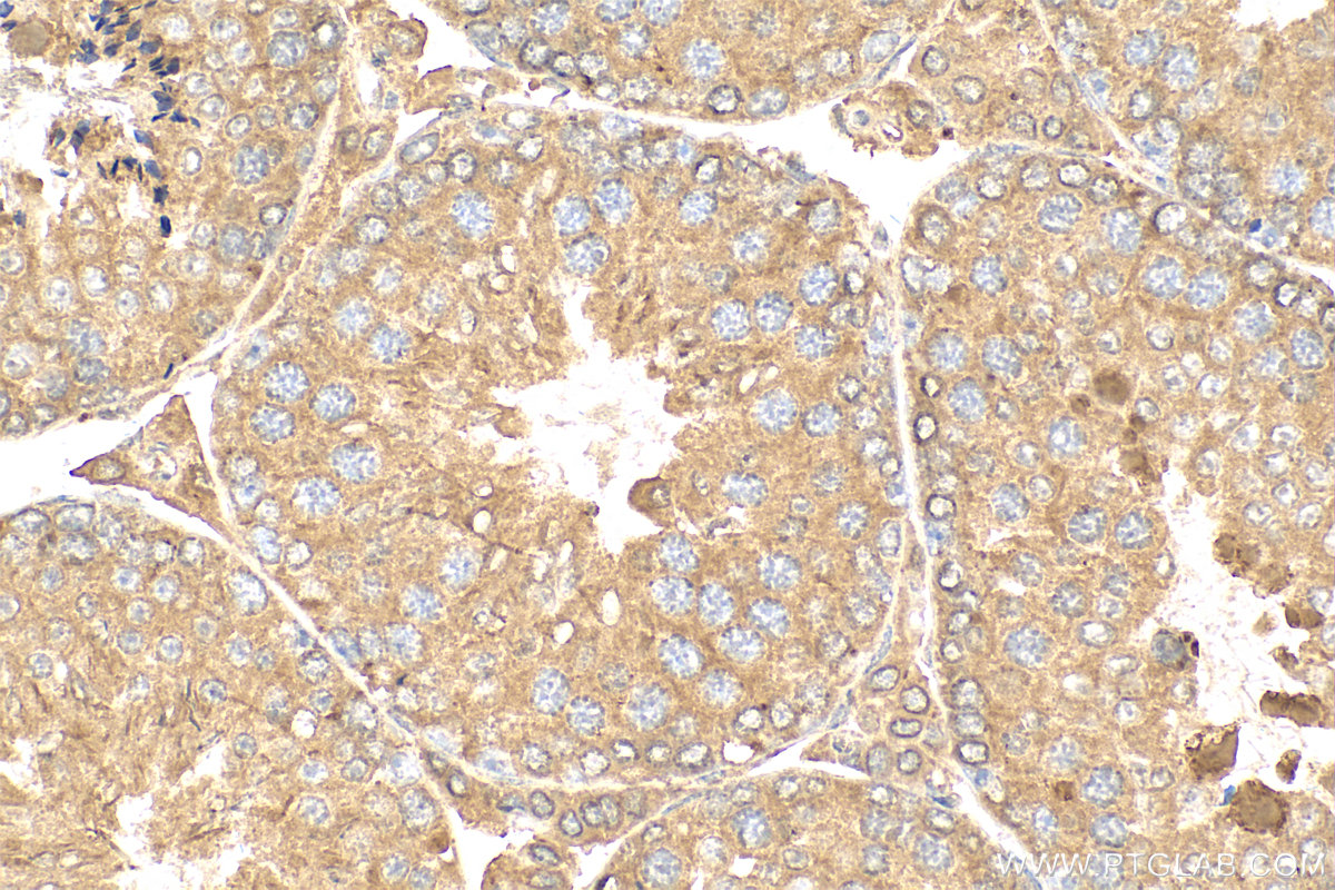 IHC staining of mouse testis using 24337-1-AP