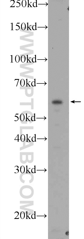 WB analysis of mouse kidney using 21118-1-AP