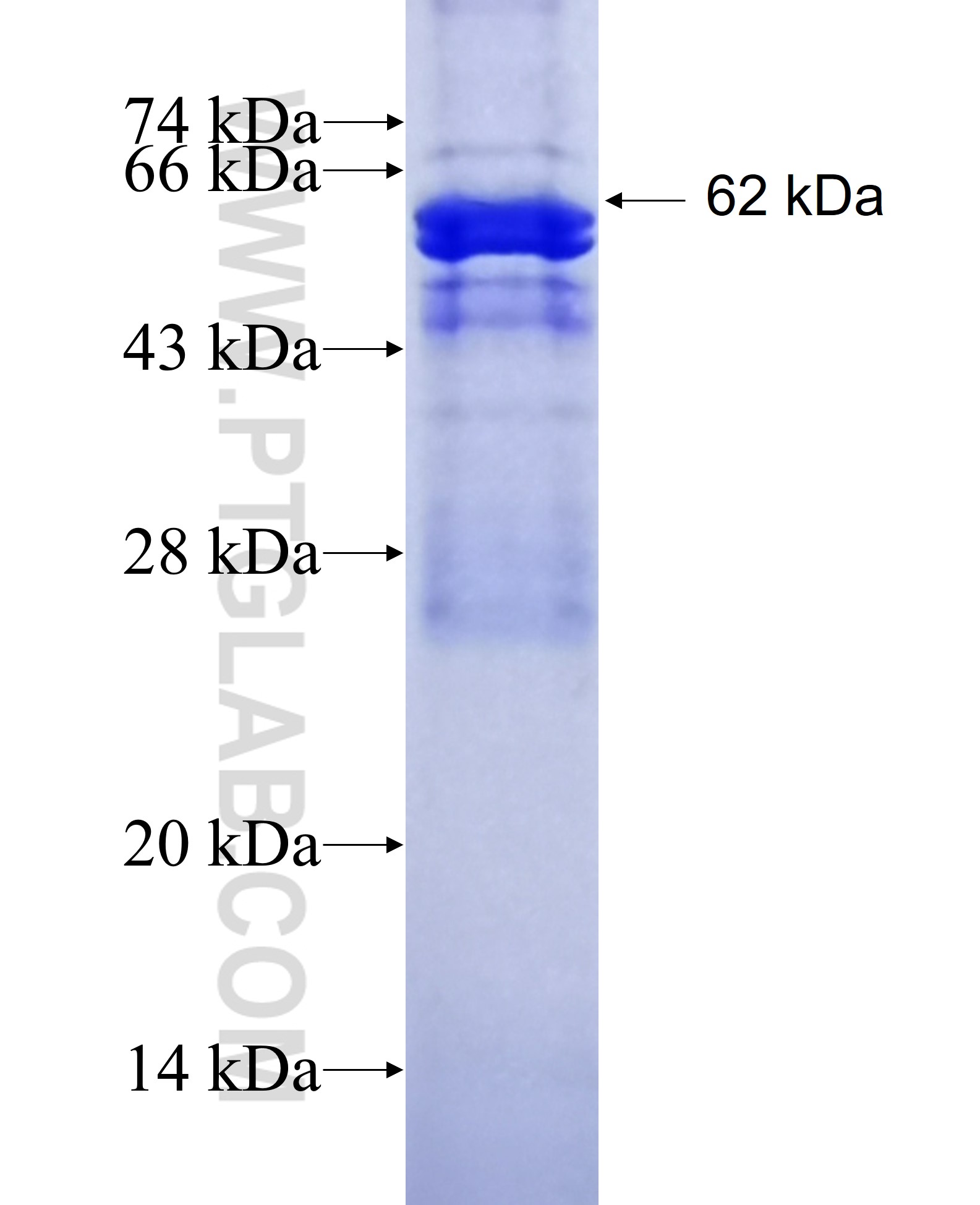 BBS1 fusion protein Ag15460 SDS-PAGE