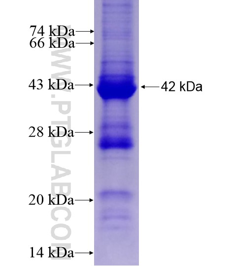 BBS1 fusion protein Ag15557 SDS-PAGE BBS1 fusion protein Ag15557 SDS-PAGE