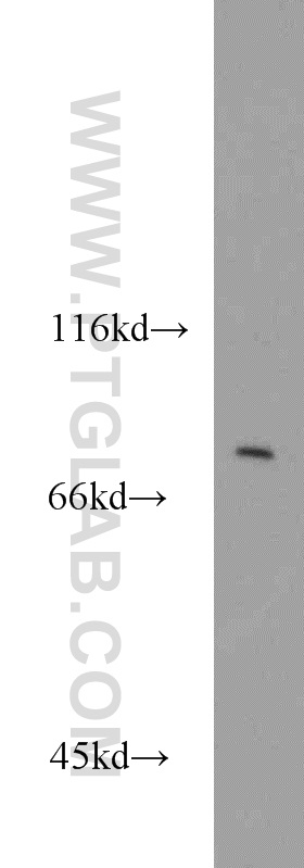 WB analysis of HepG2 using 12421-2-AP