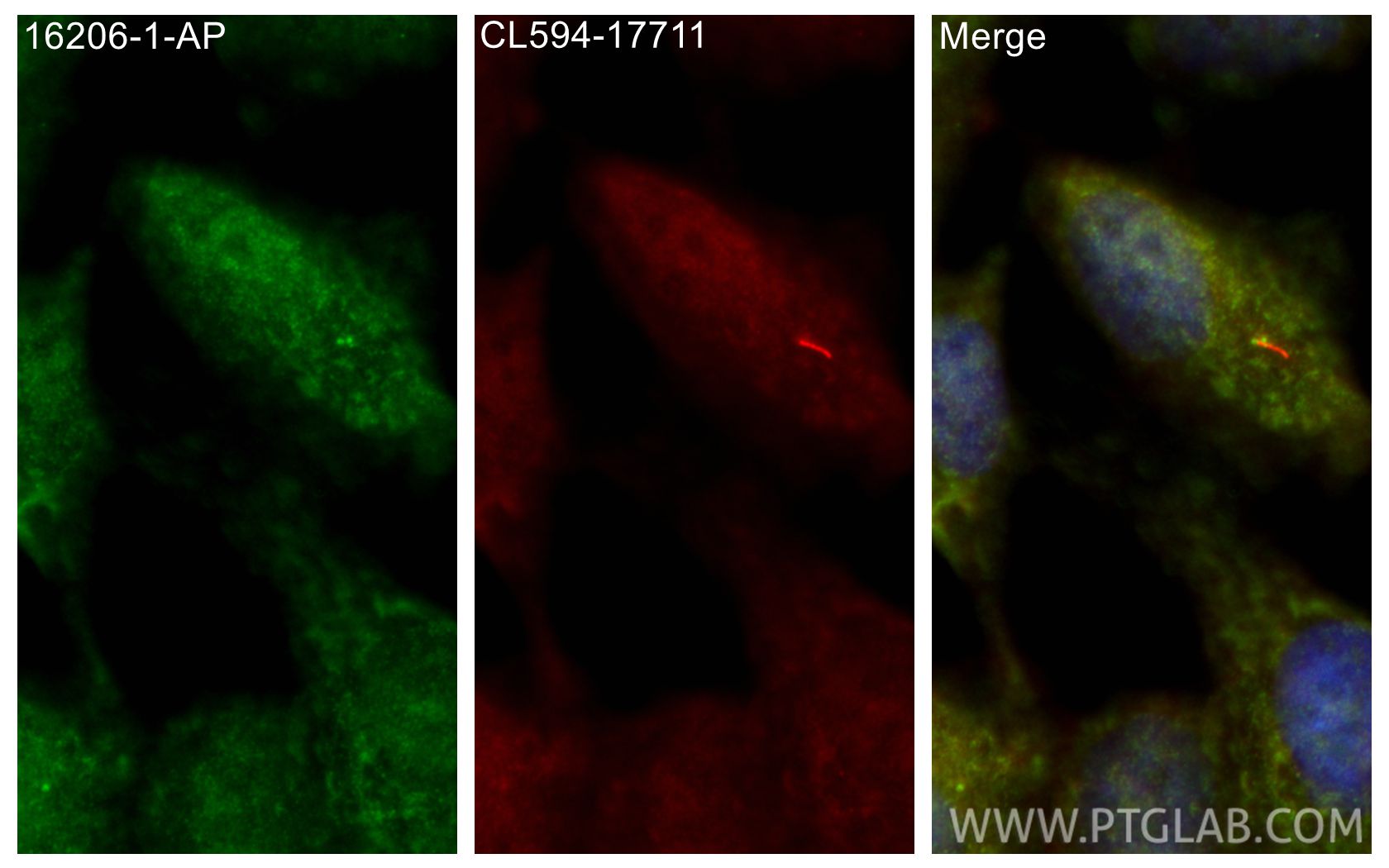 IF Staining of hTERT-RPE1 using 16206-1-AP