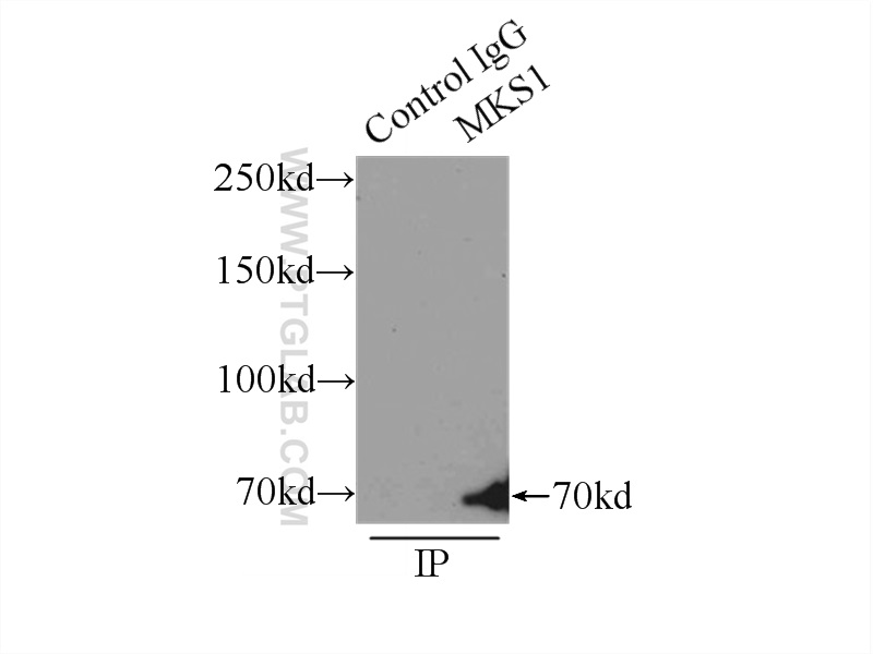 IP experiment of HEK-293 using 16206-1-AP