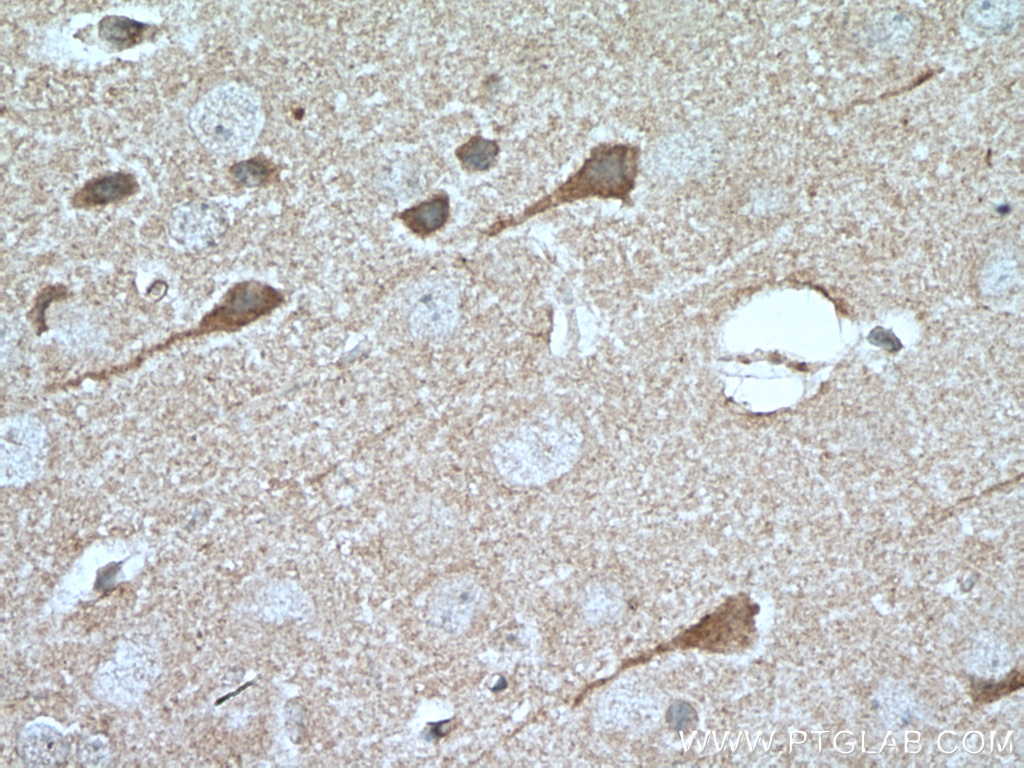 IHC staining of mouse brain using 66518-1-Ig (same clone as 66518-1-PBS)