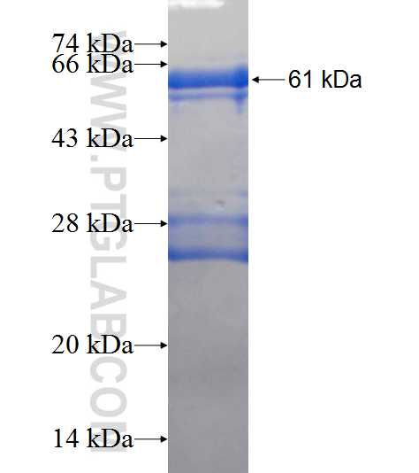 BBS13 fusion protein Ag9177 SDS-PAGE