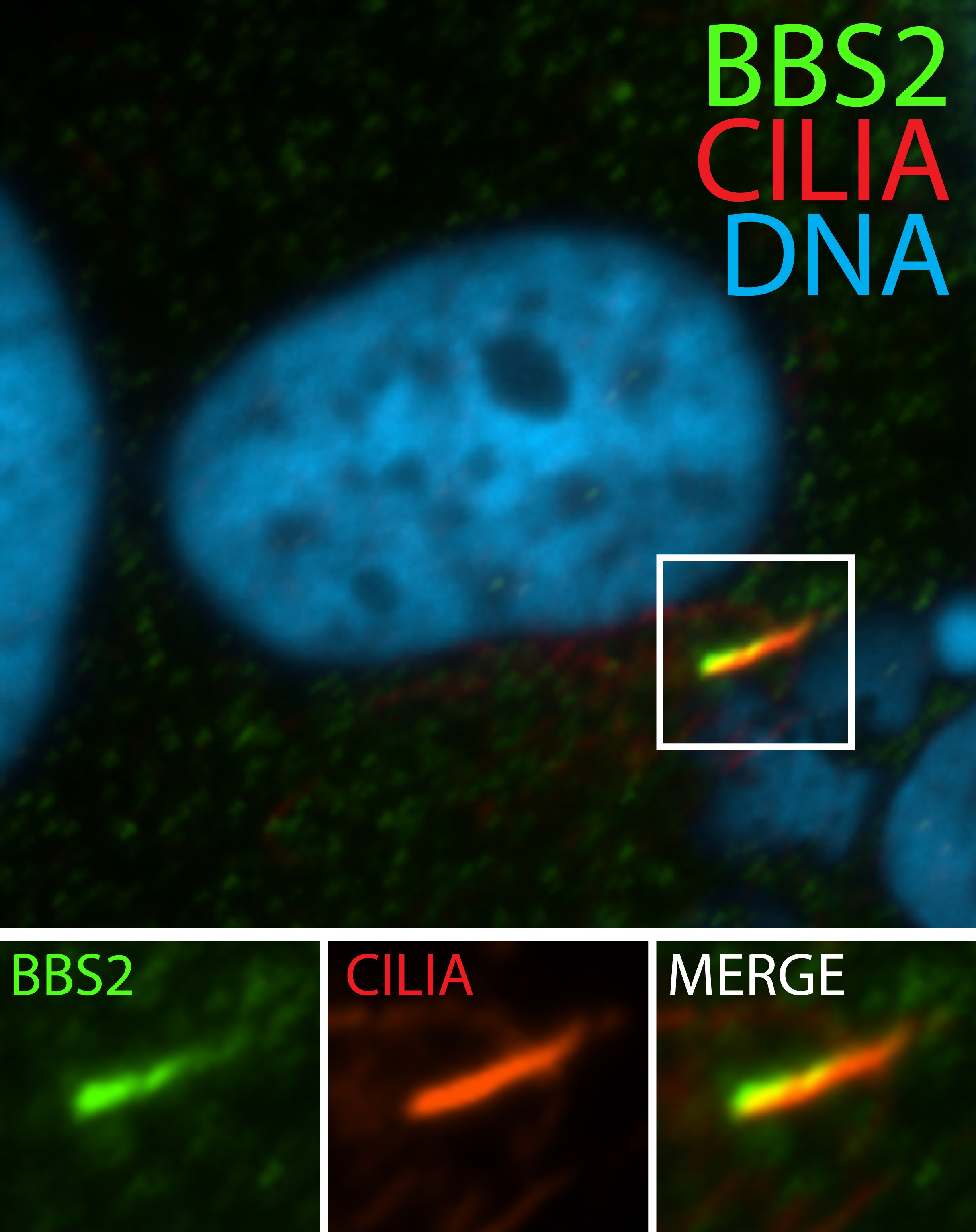 BBS2 Polyclonal antibody