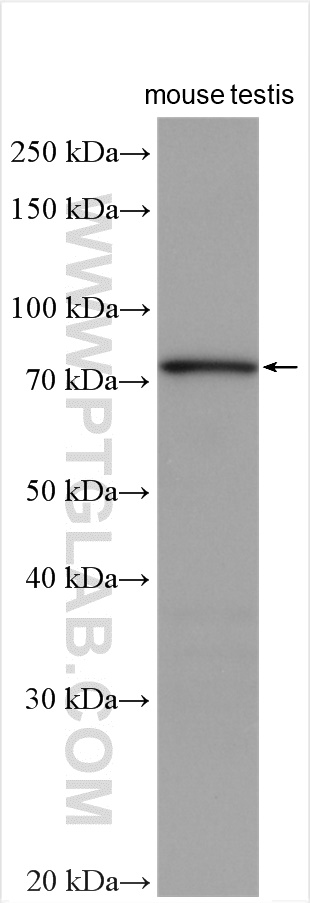 WB analysis using 11188-2-AP