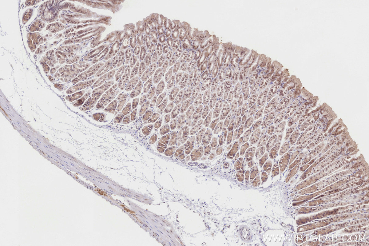 Immunohistochemical analysis of paraffin-embedded mouse stomach tissue slide using 12766-1-AP (BBS4 antibody) at dilution of 1:1000 (under 10x lens). Heat mediated antigen retrieval with Tris-EDTA buffer (pH 9.0). IHC staining of mouse stomach using 12766-1-AP