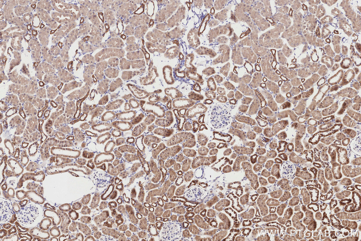 Immunohistochemical analysis of paraffin-embedded rat kidney tissue slide using 12766-1-AP (BBS4 antibody) at dilution of 1:1000 (under 10x lens). Heat mediated antigen retrieval with Tris-EDTA buffer (pH 9.0). IHC staining of rat kidney using 12766-1-AP